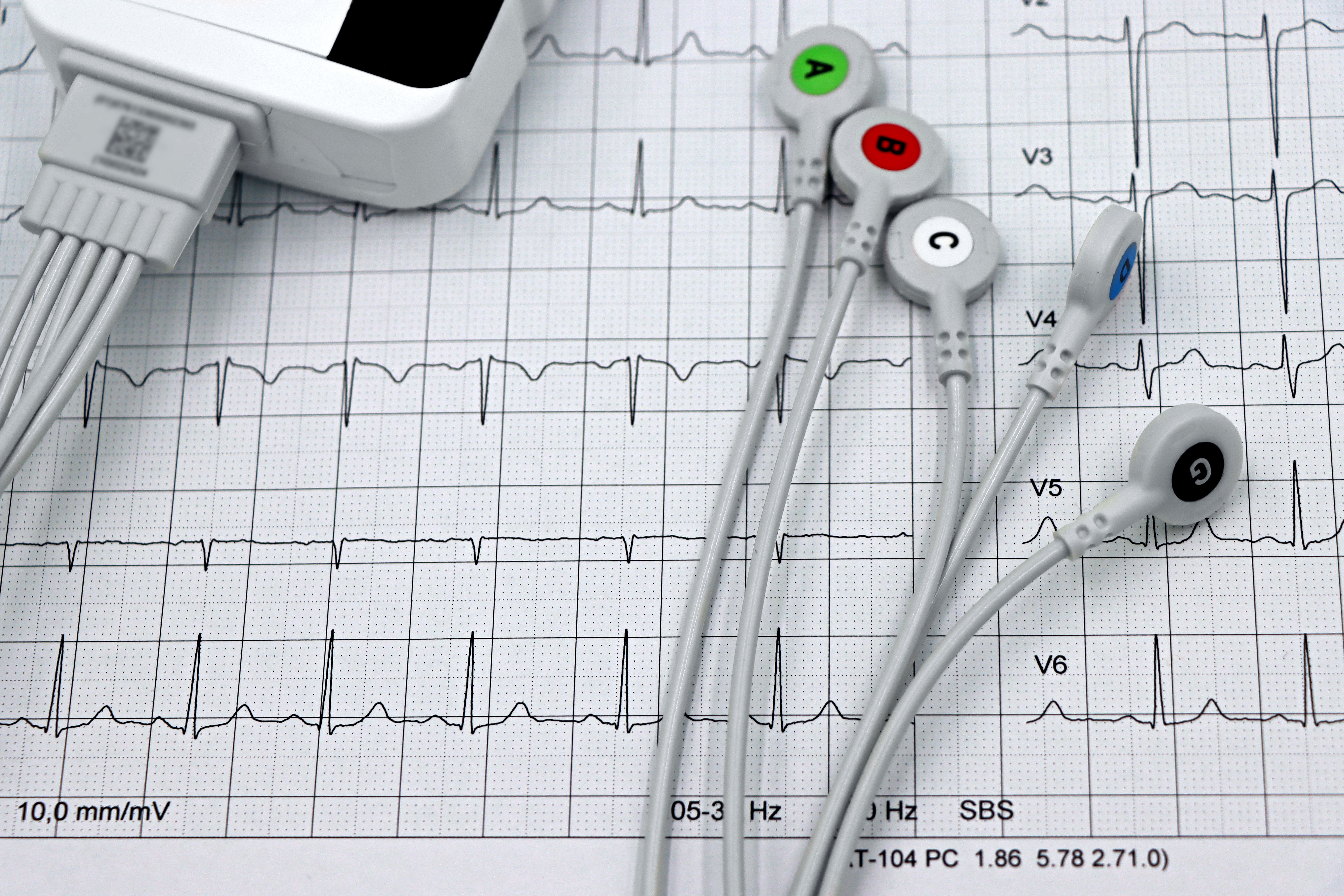 Electrocardiogram (ECG) Testing