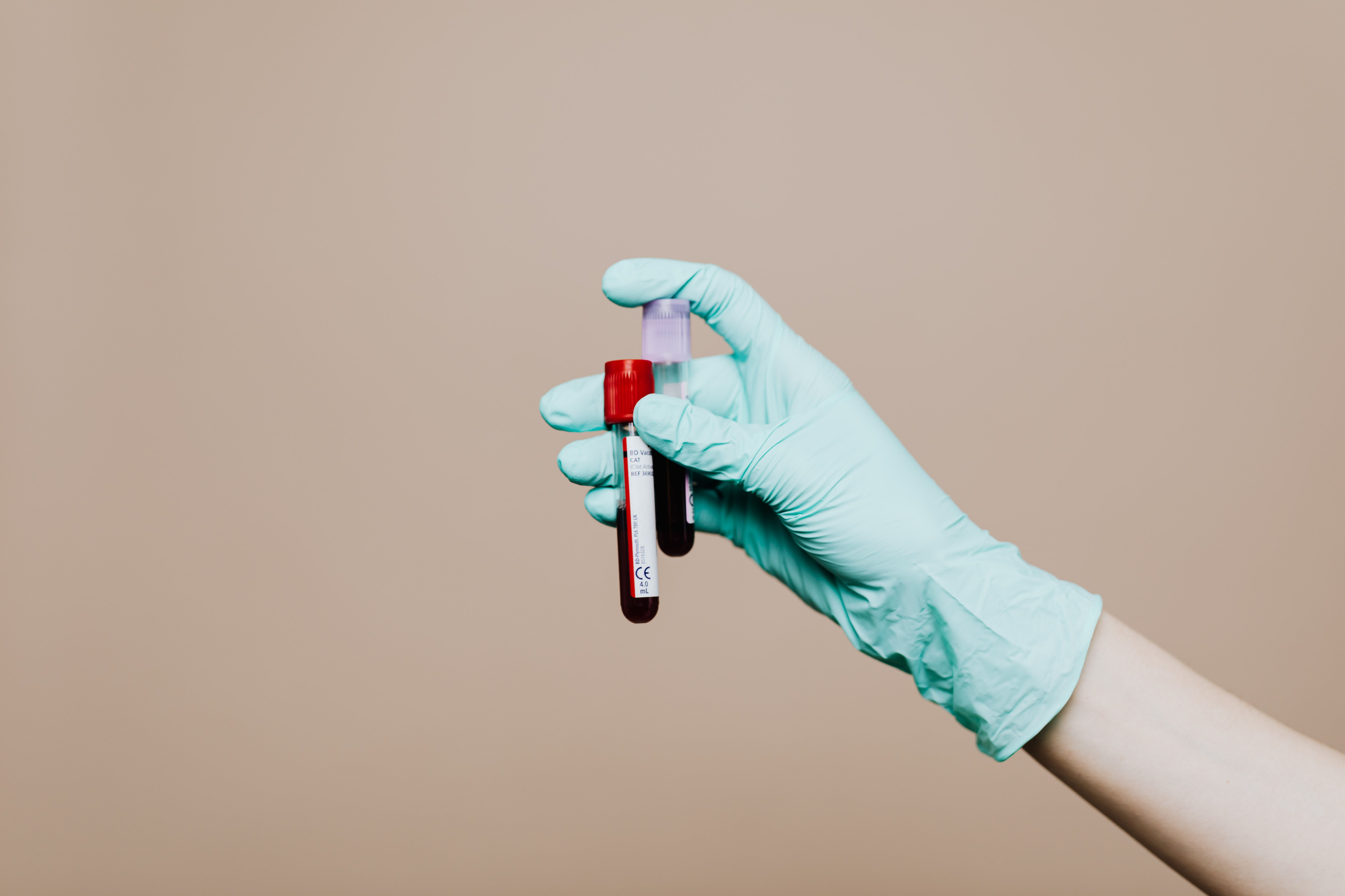 Arterial Blood Gas (ABG) Collection